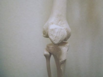 膝の骨の模型